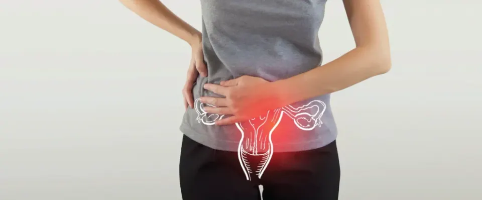 PCOS